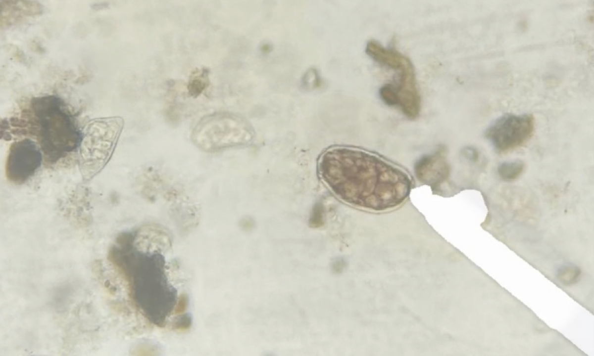 Parasitologia Digital: Diagnóstico Veterinário Automatizado